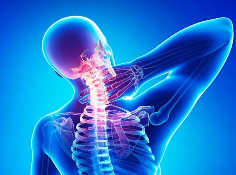 Osteochondrosis of the cervical spine