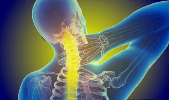 The cervical department hurts