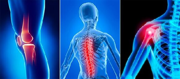The pain of the joints in the arthrosis