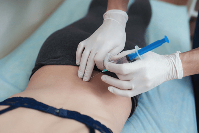 blockade for lumbar osteochondrosis