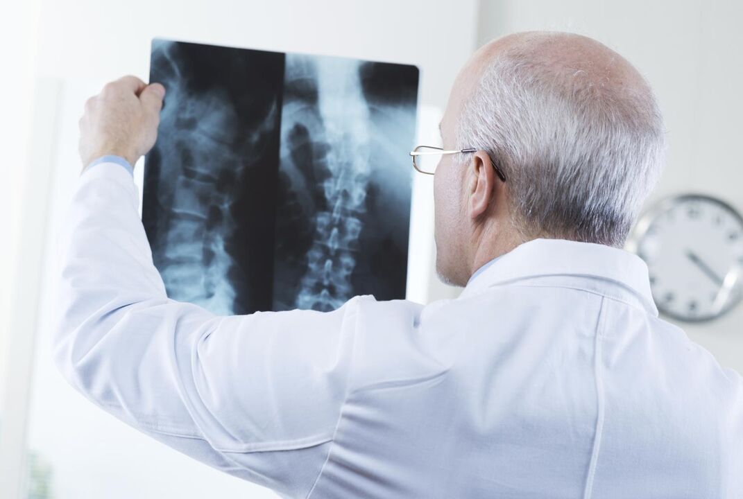 the doctor examines a photograph of the cervical spine with osteochondrosis