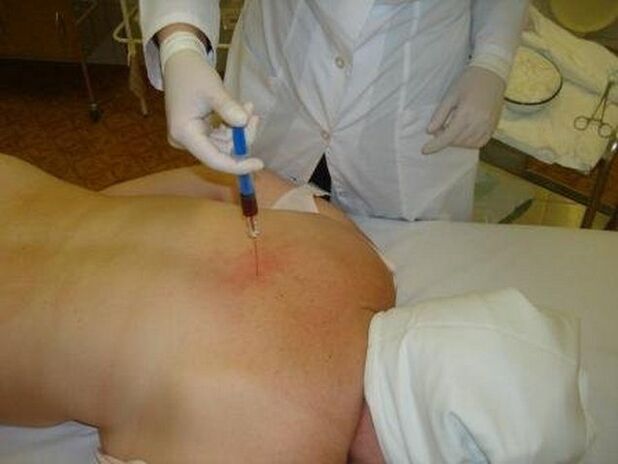 Treatment with injections